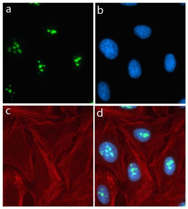 Immunocytochemistry analysis using Nucleostemin (GNL3), Rabbit mAb (3H20L2), ABfinity™ Recombinant Monoclonal Antibody (Cat. No.701157).
